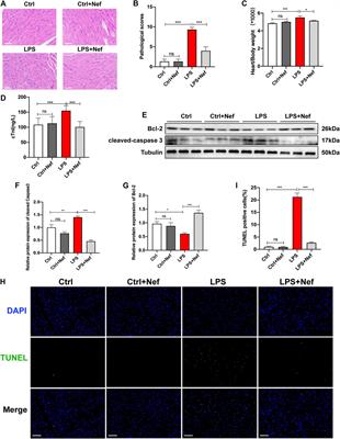 Neferine Ameliorates Sepsis-Induced Myocardial Dysfunction Through Anti-Apoptotic and Antioxidative Effects by Regulating the PI3K/AKT/mTOR Signaling Pathway